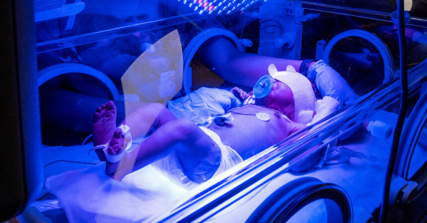 Hat Ihr Baby Zeit auf der neonatologischen Intensivstation verbracht?  Erzähl uns darüber.
