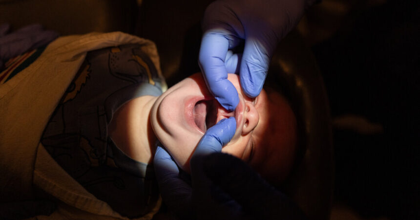 Zungenbindechirurgie: Ein Einblick in das Geschäft mit dem Zungenschneiden von Babys