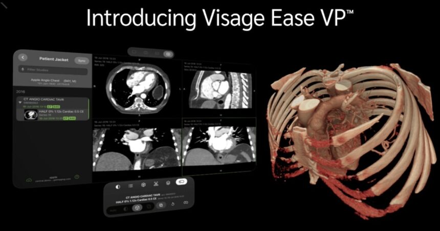 Visage Imaging bringt diagnostische Bildgebungsplattform für Apple Vision Pro auf den Markt